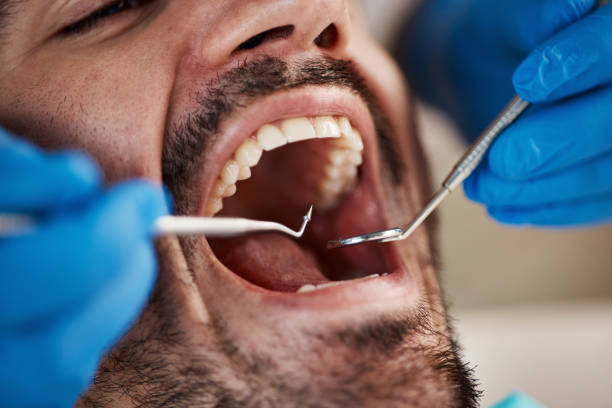 Best Emergency Treatment for Oral Infections in Hartselle, AL
