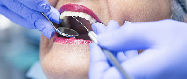 Best Emergency Dental Care for Sports Injuries in Hartselle, AL